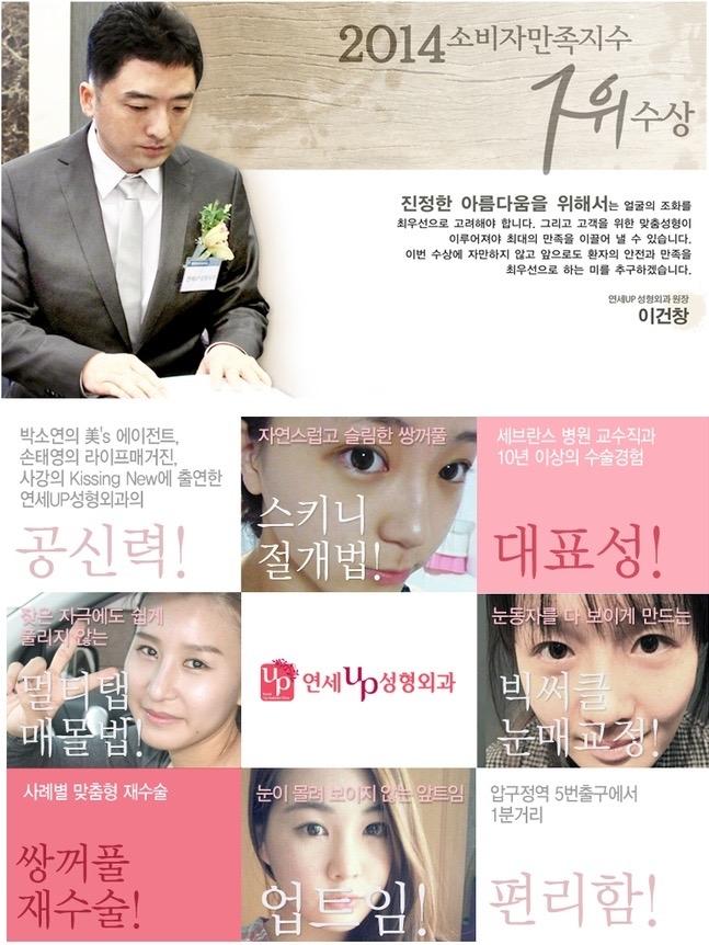 쌍꺼풀 라인의 종류-연세UP성형외과 쌍수 앞트임